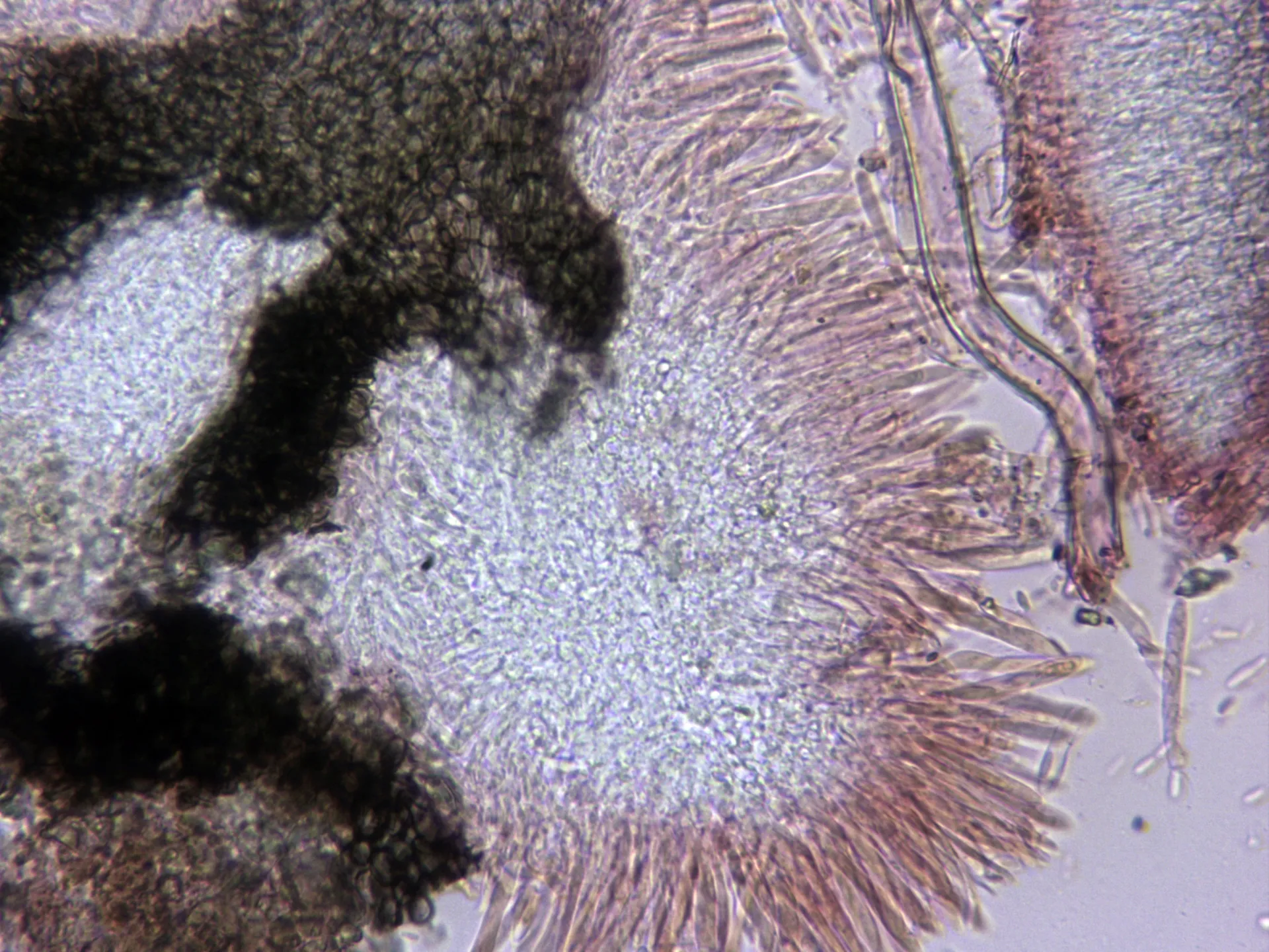 Microscopía de Pyrenopeziza chamaenerii - 11 - Sección x 400
